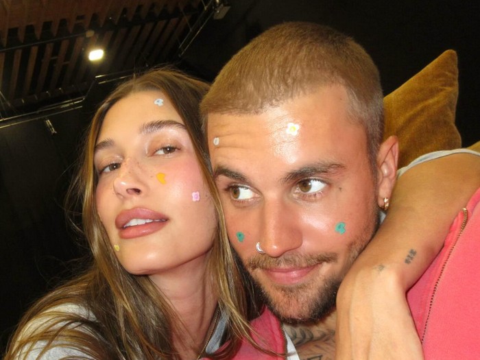 Hailey Bieber dan Justin Bieber Rilis Pimple Patch.