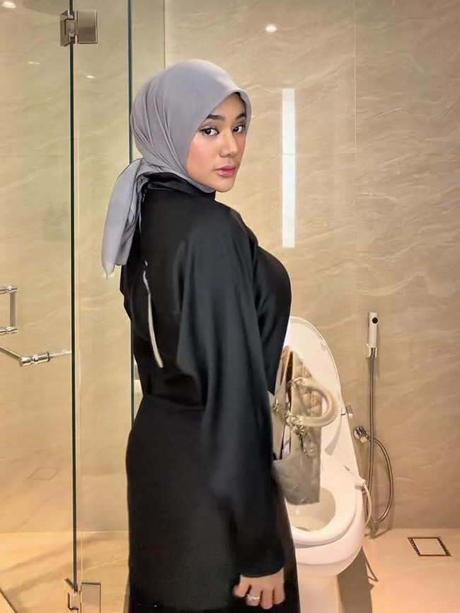 Clara Shinta Oplas Hidung di Thailand: Biaya Seharga Mobil!