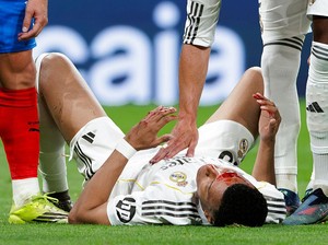Mbappe Berdarah-darah, Tak Dapat Penalti Juga
