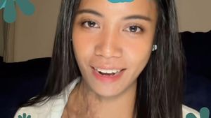 Video Kisah Wanita Bali Jalani Transplantasi Kulit Imbas Luka Bakar 85%