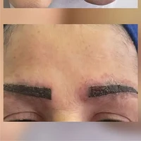 Berawal Dari Tato Alis, Wanita Ini Berakhir Alami Penyakit Serius