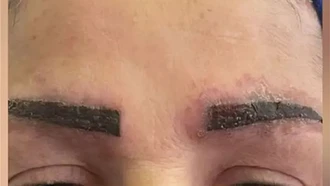 Berawal Dari Tato Alis, Wanita Ini Berakhir Alami Penyakit Serius