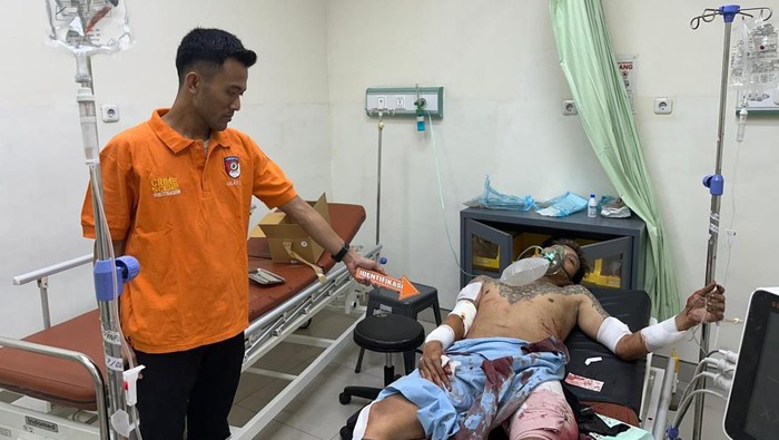 Korban Antonius alias Copet saat mendapat perawatan medis setelah dibacok pelaku di Jalan Desa Hulaan, Menganti