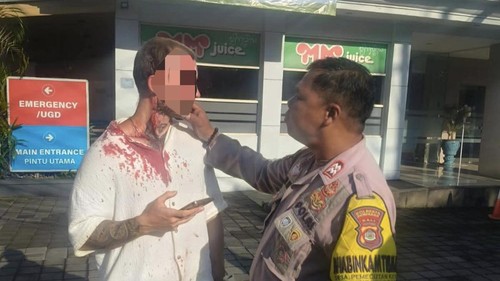 WN Prancis yang diduga terlibat kasus penganiayaan di sebuah gym di Denpasar Barat, Rabu (15/4/2026). Dok: Facebook, Putu Mita Atmaja