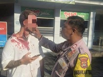 Korban Penganiayaan Bule Prancis di Gym Denpasar Pilih Mediasi