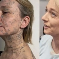 Kejam! Wanita Ini Dipaksa Tato 250 Nama Pacar di Tubuh & Wajah