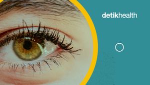 Video: Arah Tumbuh Bulu Mata Kebalik, Normal atau Kelainan?