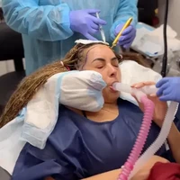 Niat Glow Up, Rambut Wanita Ini Malah Jadi Uban Setelah Transplantasi