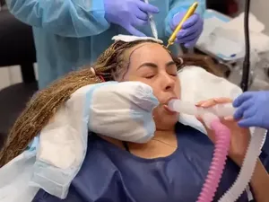 Niat Glow Up, Rambut Wanita Ini Malah Jadi Uban Setelah Transplantasi