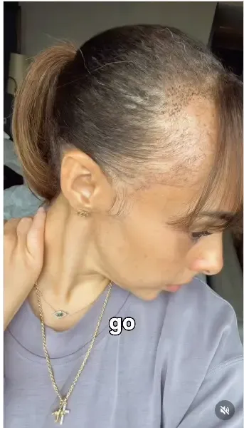 Nini B Nini B
