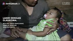 Video: Alami Glaukoma Sejak Lahir, Balita Wulan Tidak Kehilangan Harapan