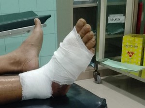 Pria di Brebes Digigit Ular Viper Saat Cari Rumput, Kaki Melepuh