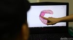 Teknologi Digital Dorong Transformasi Perawatan Gigi di Indonesia