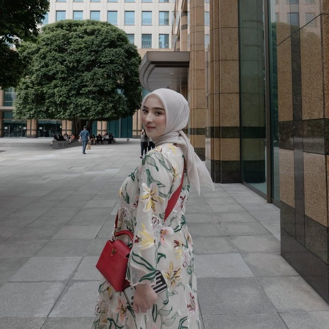 Dinan Fajrina Soal Hidung Disangka Oplas