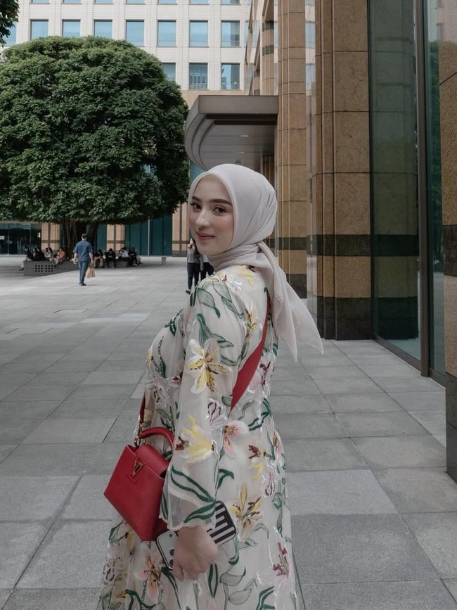 Dinan Fajrina Soal Hidung Disangka Oplas