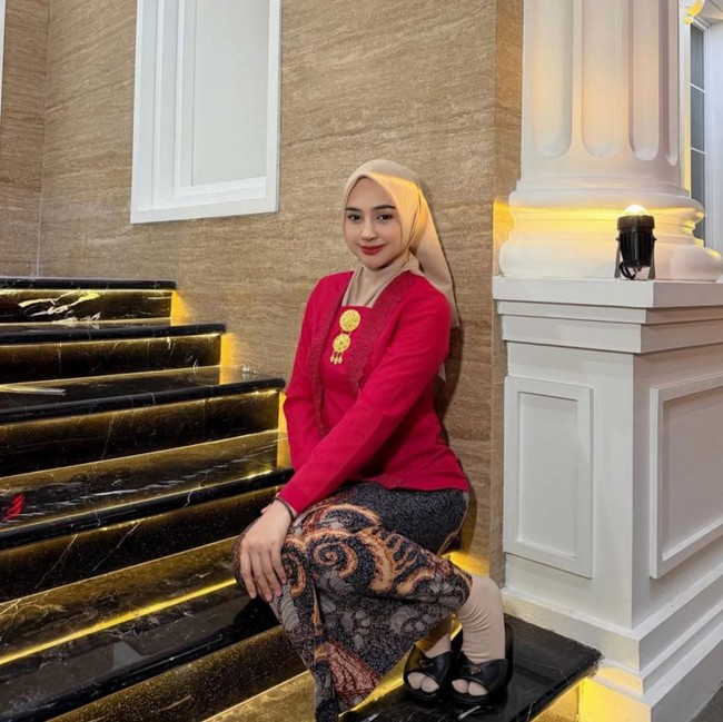 Potret Transformasi Ria Ricis Sebelum dan Setelah Oplas, Bikin Pangling!