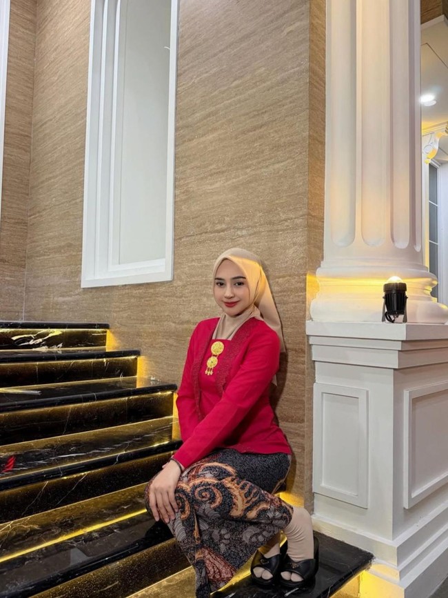 Potret Transformasi Ria Ricis Sebelum dan Setelah Oplas, Bikin Pangling!