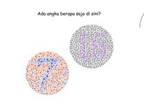 Ketajaman Mata Diuji di Permainan Ini, Kalau Tak Buta Warna Harusnya Mudah