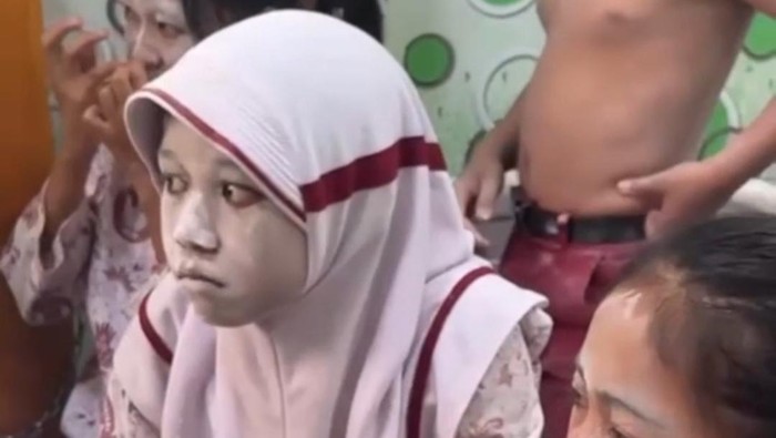 Siswa alami gatal-gatal usai makan MBG di Sampang