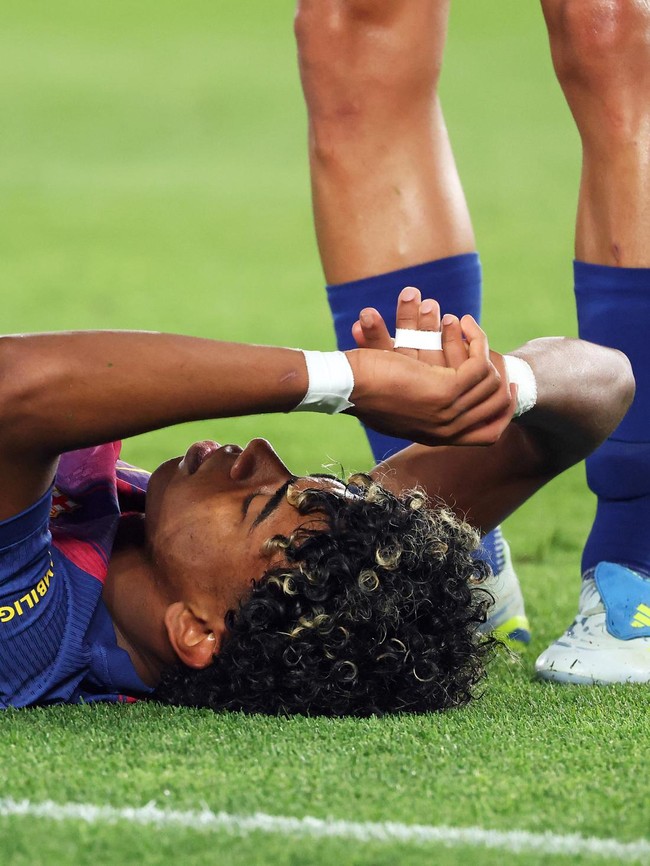 Jelang Piala Dunia 2026, Mereka Malah Cedera