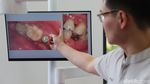 Peran Teknologi dalam Meningkatkan Akurasi Diagnosis Gigi