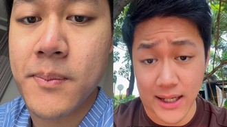 Pria Jakut Kena Kanker Limfoma di Usia 25 Tahun, Inikah Penyebabnya?