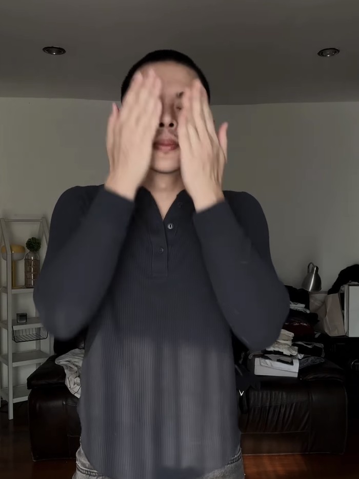 Rey Mbayang Idap Autoimun Psoriasis