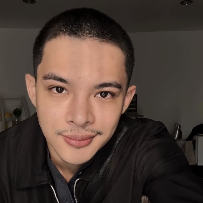 Rey Mbayang Idap Autoimun Psoriasis