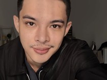 Rey Mbayang Idap Autoimun Psoriasis