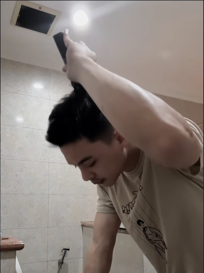 Rey Mbayang Idap Autoimun Psoriasis