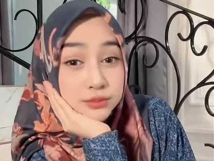 Ria Ricis Luruskan soal Operasi Hidung dan Wajah Berubah