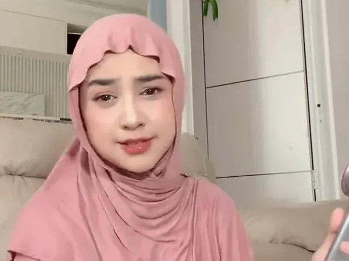 Ria Ricis Luruskan soal Operasi Hidung dan Wajah Berubah