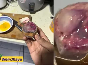Shock! Pecahin Telur, Isinya Bukan Kuning Tapi Embrio Bergerak