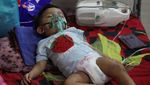 Wabah Campak Melonjak, Rumah Sakit Kewalahan