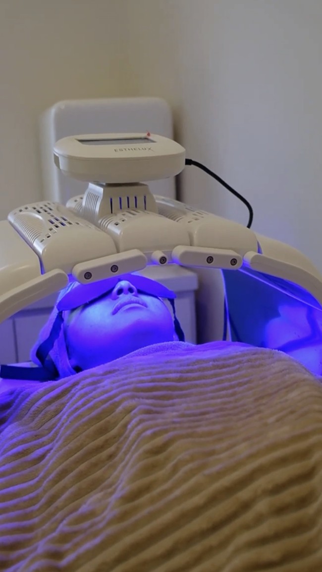 Syifa juga melakukan cne laser untuk menjaga wajah tetap bebas jerawat, hingga vascular laser untuk mengatasi kemerahan atau bekas jerawat. Selain itu, ada juga treatment pendukung seperti photodynamic therapy (PDT) yang membantu proses regenerasi kulit. Foto: dok. Dermalogia