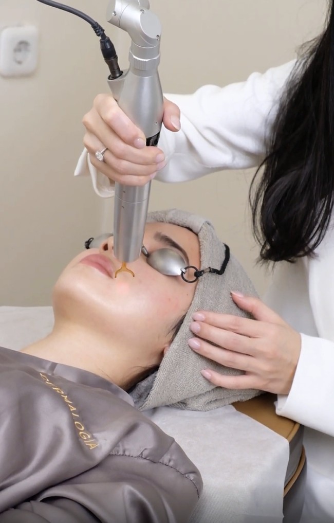 Diketahui, Syifa memang sudah menjalani berbagai treatment di klinik kecantikan sejak beberapa tahun terakhir. Rutinitas ini semakin intens menjelang pernikahan, dengan fokus pada menjaga skin barrier tetap sehat, meratakan warna kulit, dan memastikan wajah dalam kondisi paling optimal. Beberapa perawatan yang dijalani aktris 25 tahun itu antara lain pico laser untuk mencerahkan dan meratakan warna kulit Foto: dok. Dermalogia