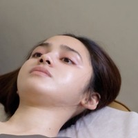 Menjelang hari pernikahannya, Syifa Hadju melakukan sejumlah perawatan kecantikan. Dalam beberapa momen yang dibagikan, wajahnya terlihat polos tanpa riasan, memperlihatkan kondisi kulit yang tampak sehat dan glowing. Foto: dok. Dermalogia