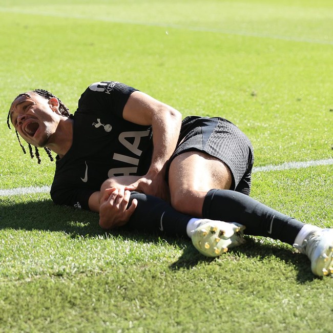 Tottenham Remuk, 6 Penyerangnya Cedera Panjang