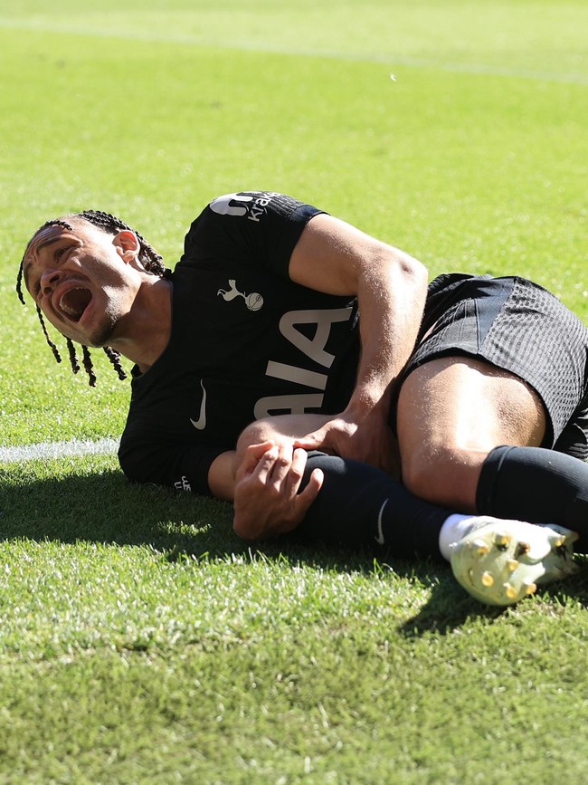 Tottenham Remuk, 6 Penyerangnya Cedera Panjang