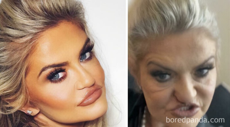 Deretan foto medsos vs realita