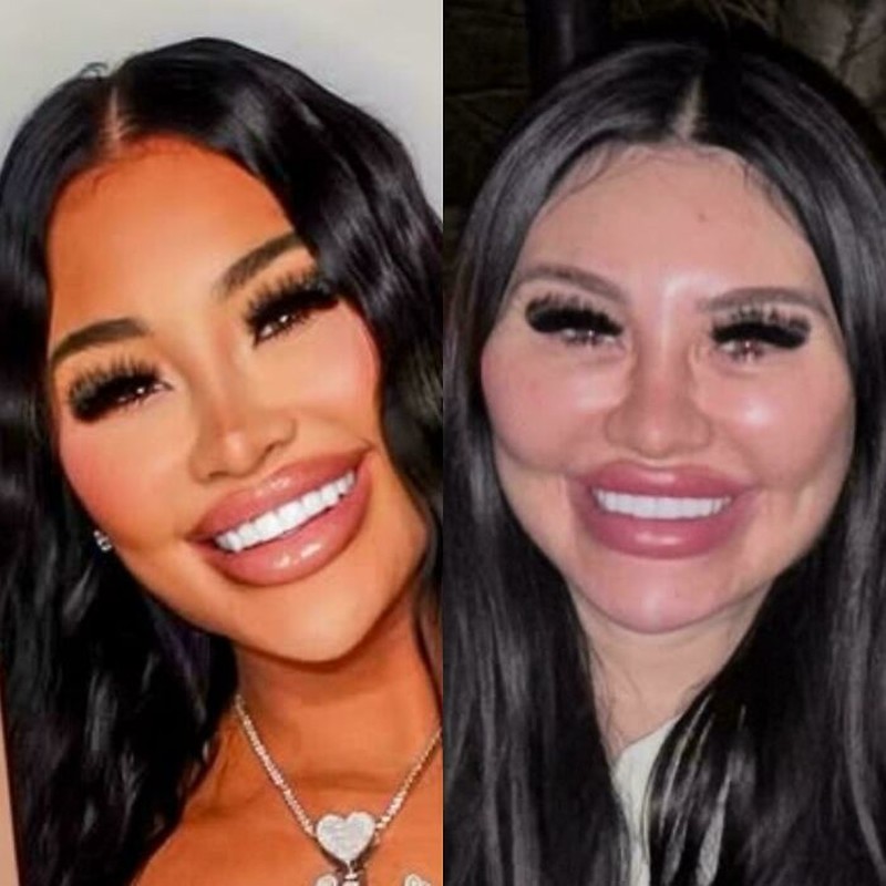 Deretan foto medsos vs realita
