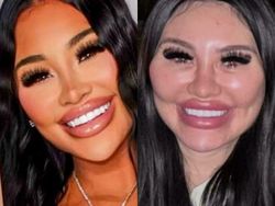 Foto Medsos vs Realita, Bedanya Bikin Kaget dan Tercengang!