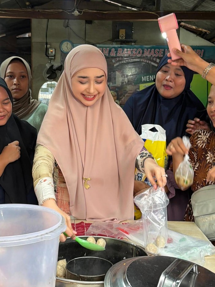Ria Ricis alasan operasi hidung.