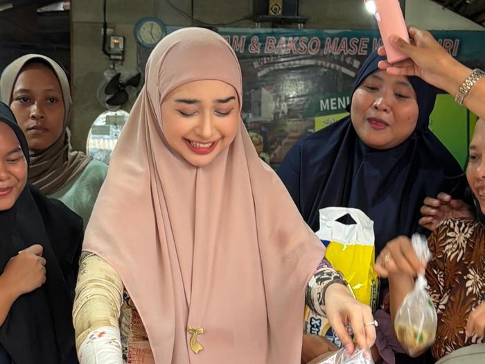 Ria Ricis Ungkap Alasan Operasi Hidung