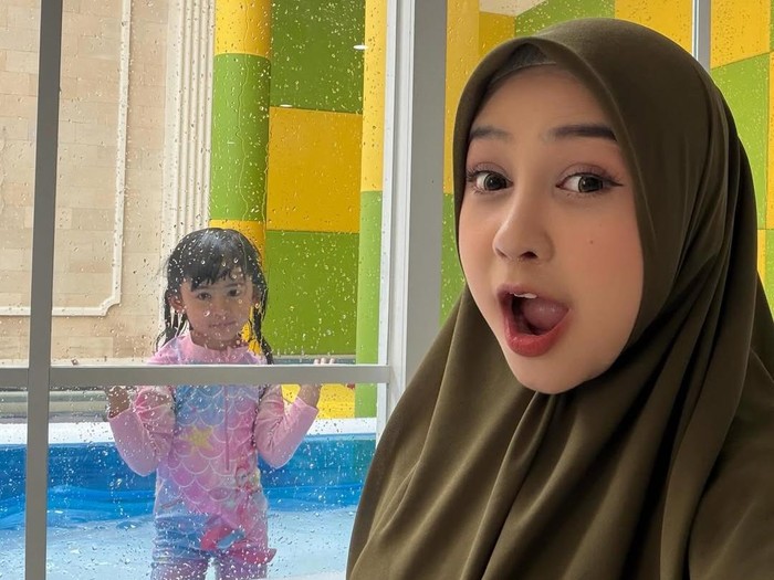 Ria Ricis alasan operasi hidung.