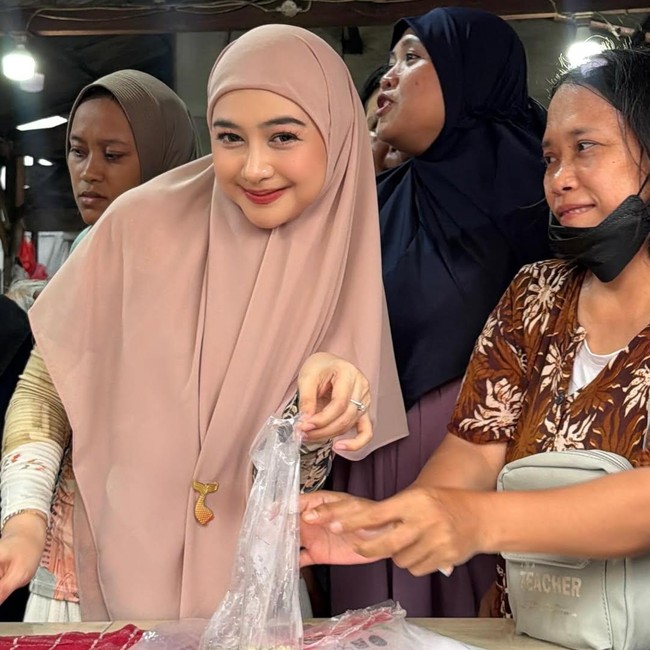 Ria Ricis Luruskan soal Operasi Hidung dan Wajah Berubah