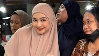 Ria Ricis Luruskan soal Operasi Hidung dan Wajah Berubah