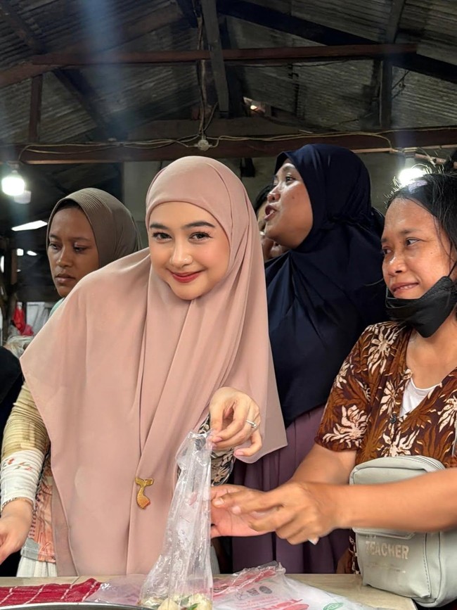 Ria Ricis Luruskan soal Operasi Hidung dan Wajah Berubah