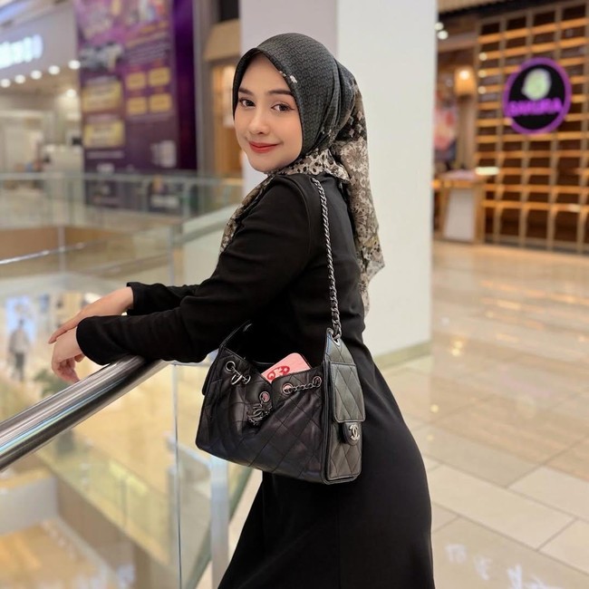 Ria Ricis Ungkap Alasan Operasi Hidung