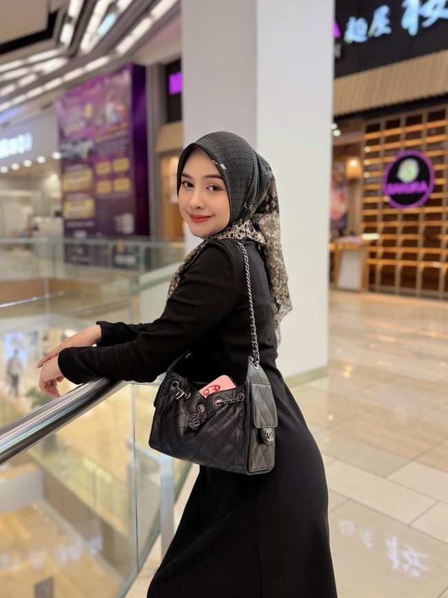 Ria Ricis Ungkap Alasan Operasi Hidung